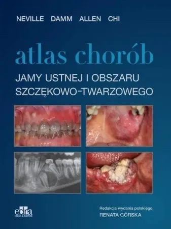 Atlas chorób jamy ustnej i obszaru szczękowo.. - Brad Neville Angela Chi Douglas Carl Allen D. Damm Zamów dziś